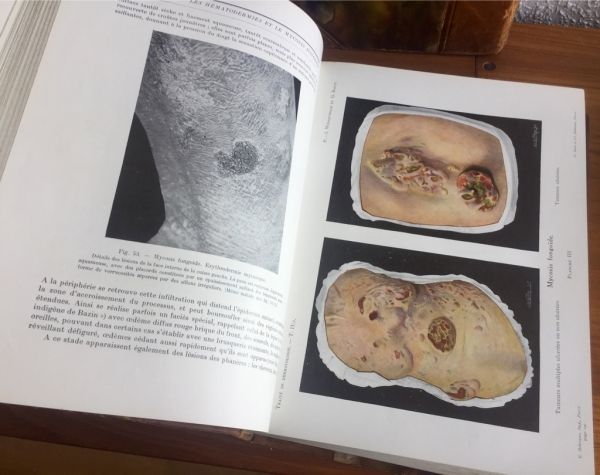 Traité de Dermatologie Clinique et Thérapeutique I y II
