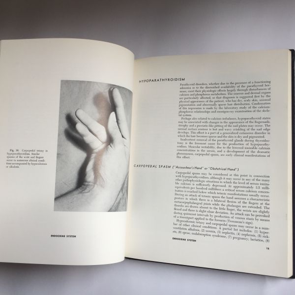 Mano The HAND as mirror of systemic disease, J. Berry 1963