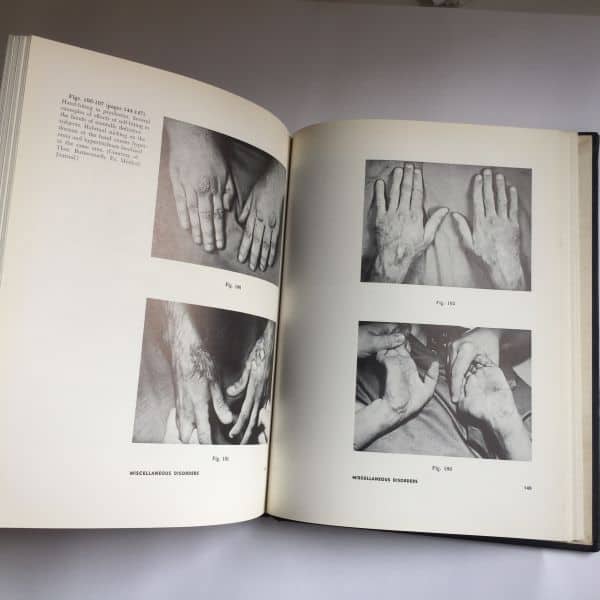 The HAND as mirror of systemic disease, J. Berry. Fotografías de manos