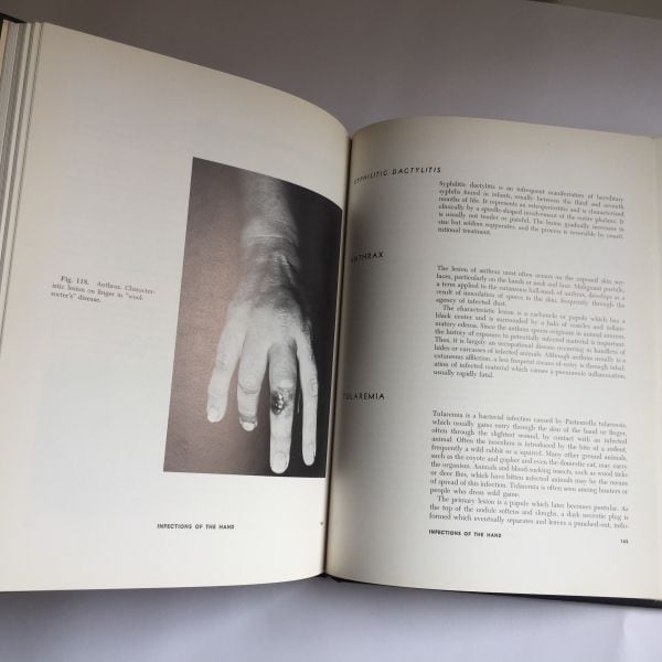 Foto mano The HAND as mirror of systemic disease, J. Berry 1963