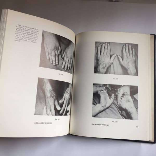 The HAND as mirror of systemic disease, Theodore J. Berry