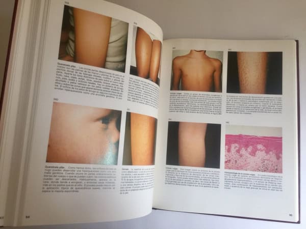 Ilustraciones Atlas de Dermatología Pediátrica 1